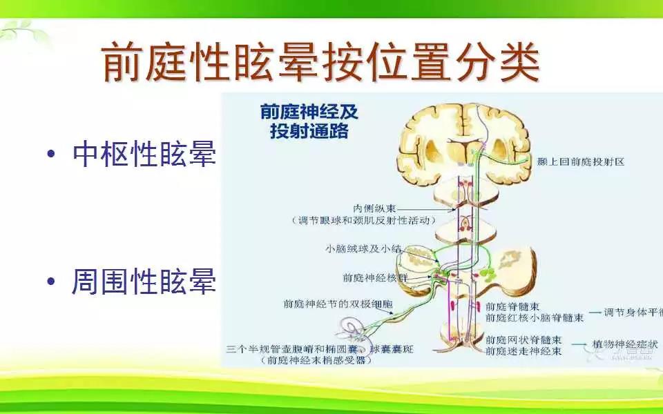 前庭性眩晕按位置分类